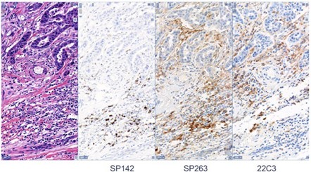 IHC PD-L1 stainings