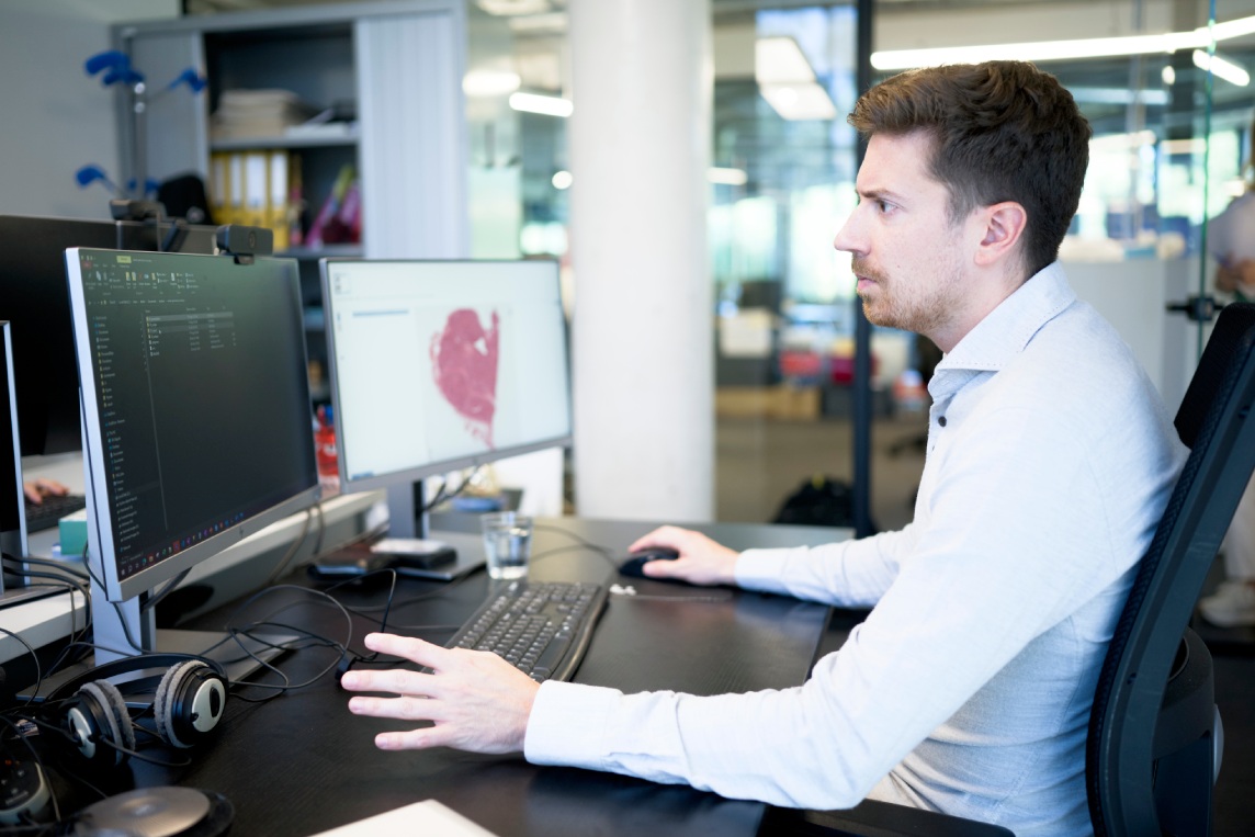AI-powered pathology image analysis