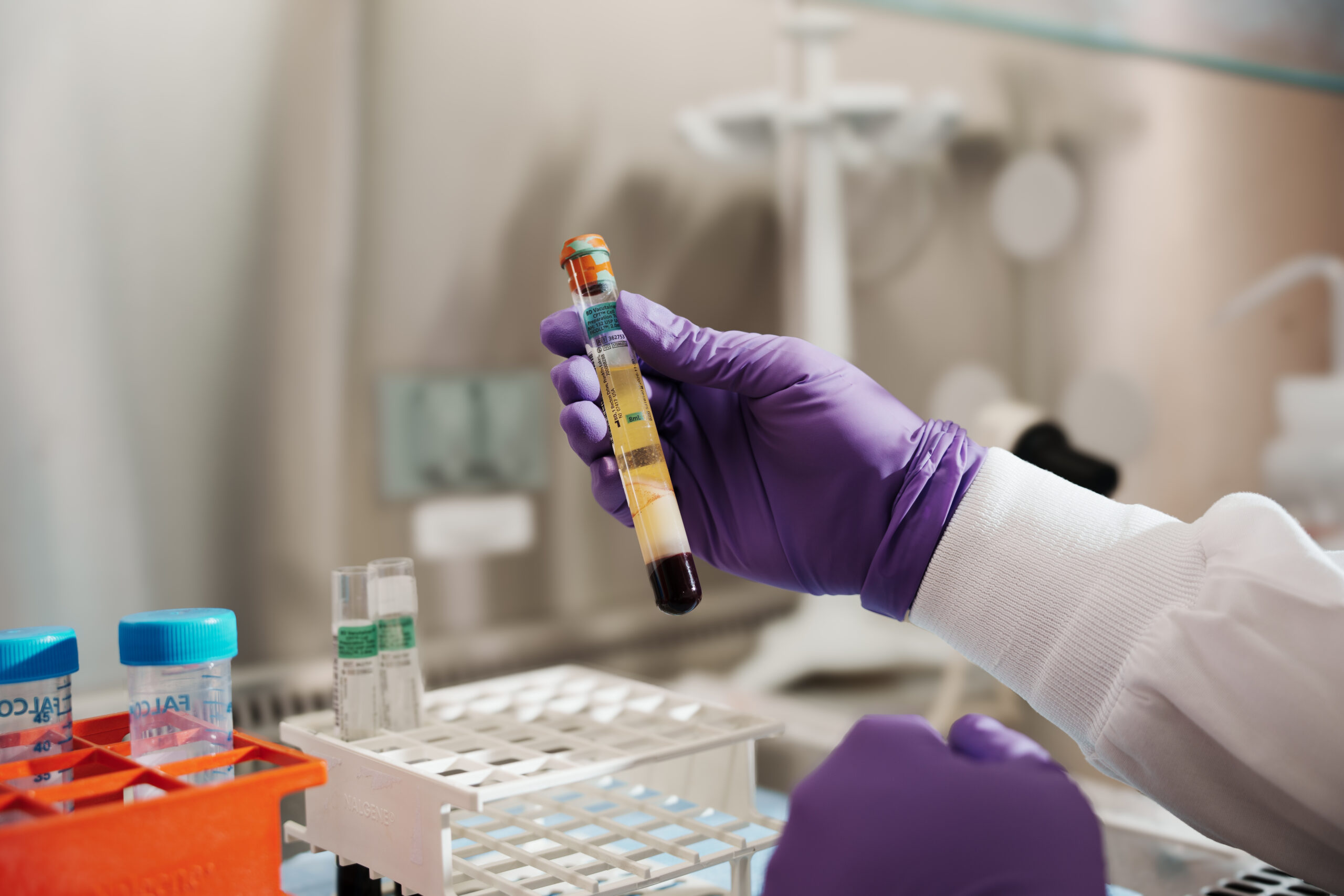 Gloved hand holding a labeled blood sample tube during biospecimen procurement.
